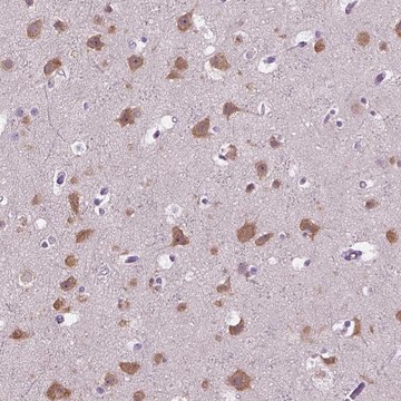 Anti-GAS7 antibody produced in rabbit Prestige Antibodies&#174; Powered by Atlas Antibodies, affinity isolated antibody, buffered aqueous glycerol solution