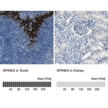 Anti-SPINK5 antibody produced in rabbit Prestige Antibodies&#174; Powered by Atlas Antibodies, affinity isolated antibody, buffered aqueous glycerol solution