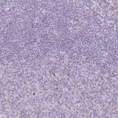 Anti-RASL10B antibody produced in rabbit Prestige Antibodies® Powered by Atlas Antibodies, affinity isolated antibody, buffered aqueous glycerol solution