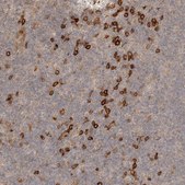 Anti-CLEC4C antibody produced in rabbit Prestige Antibodies® Powered by Atlas Antibodies, affinity isolated antibody, buffered aqueous glycerol solution