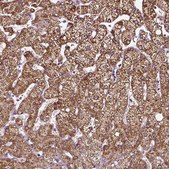 Anti-AADAT antibody produced in rabbit Prestige Antibodies® Powered by Atlas Antibodies, affinity isolated antibody, buffered aqueous glycerol solution