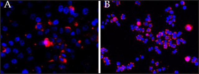 Anti-CEP290 antibody produced in goat affinity isolated antibody, buffered aqueous solution