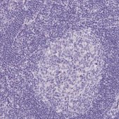 Anti-CYSTM1 antibody produced in rabbit Prestige Antibodies® Powered by Atlas Antibodies, affinity isolated antibody, buffered aqueous glycerol solution