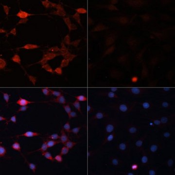 Anti-P70 S6K antibody produced in rabbit