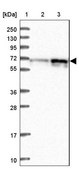 Anti-RIC8A antibody produced in rabbit Prestige Antibodies® Powered by Atlas Antibodies, affinity isolated antibody, buffered aqueous glycerol solution