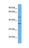 Anti-SPDEF (AB1) antibody produced in rabbit affinity isolated antibody
