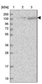 Anti-U2SURP antibody produced in rabbit Prestige Antibodies® Powered by Atlas Antibodies, affinity isolated antibody, buffered aqueous glycerol solution