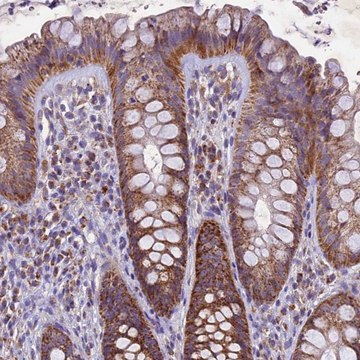 Anti-PMPCB antibody produced in rabbit Prestige Antibodies&#174; Powered by Atlas Antibodies, affinity isolated antibody, buffered aqueous glycerol solution