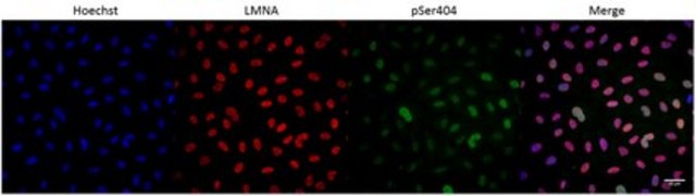 Anti-Phospho-Lamin A/C (Ser404) from rabbit