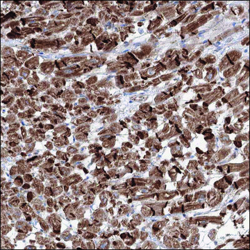 Anti-CDK5RAP2 antibody produced in rabbit Prestige Antibodies&#174; Powered by Atlas Antibodies, affinity isolated antibody, buffered aqueous glycerol solution