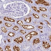 Anti-SLC7A9 antibody produced in rabbit Prestige Antibodies® Powered by Atlas Antibodies, affinity isolated antibody, buffered aqueous glycerol solution