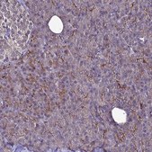 Anti-NSMF antibody produced in rabbit Prestige Antibodies® Powered by Atlas Antibodies, affinity isolated antibody, buffered aqueous glycerol solution