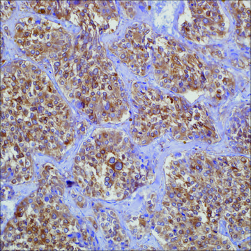 NSE (MRQ-55) Mouse Monoclonal Antibody