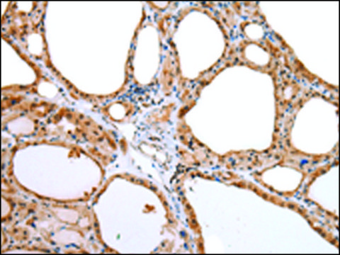 Anti-AQP9 affinity isolated antibody