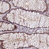 Anti-TMEM116 antibody produced in rabbit affinity isolated antibody, buffered aqueous glycerol solution