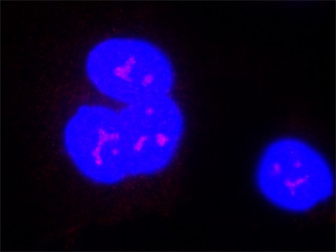 Anti-FLVCR1 antibody, Mouse monoclonal clone FL-58, purified from hybridoma cell culture