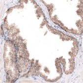 Monoclonal Anti-CLDN1 antibody produced in mouse Prestige Antibodies® Powered by Atlas Antibodies, clone CL3698, purified immunoglobulin, buffered aqueous glycerol solution