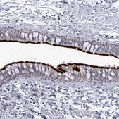 Anti-CCDC181 antibody produced in rabbit Prestige Antibodies® Powered by Atlas Antibodies, affinity isolated antibody, buffered aqueous glycerol solution, ab3