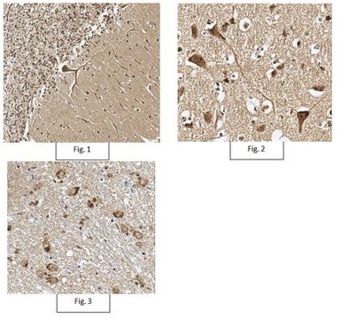 Anti-phospho PSD95 Antibody (Thr19) from rabbit, purified by affinity chromatography