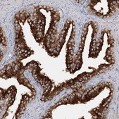 Anti-SYTL1 antibody produced in rabbit Prestige Antibodies® Powered by Atlas Antibodies, affinity isolated antibody, buffered aqueous glycerol solution