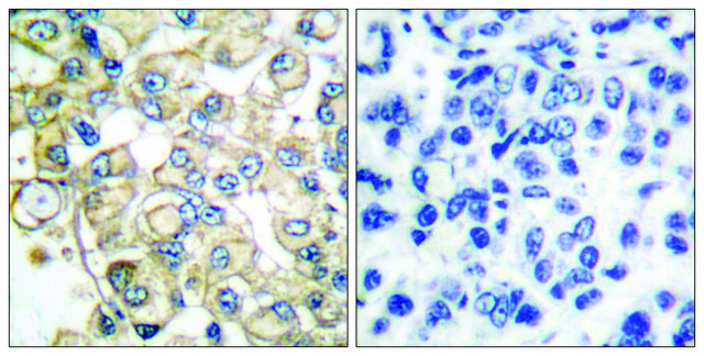 Anti-FGFR1 antibody produced in rabbit affinity isolated antibody