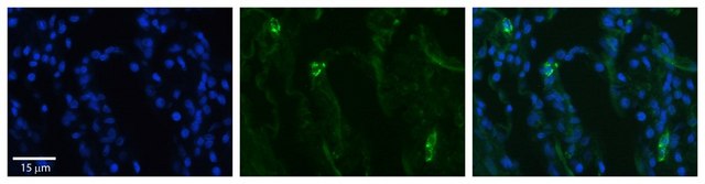 Anti-SLCO2B1 antibody produced in rabbit affinity isolated antibody