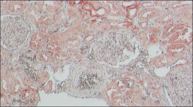 Anti-ACE2 antibody produced in rabbit affinity isolated antibody, buffered aqueous solution