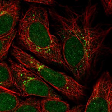 Anti-PPP2R3C antibody produced in rabbit Prestige Antibodies&#174; Powered by Atlas Antibodies, affinity isolated antibody