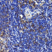 Anti- NF-kB p65/RelA antibody produced in rabbit