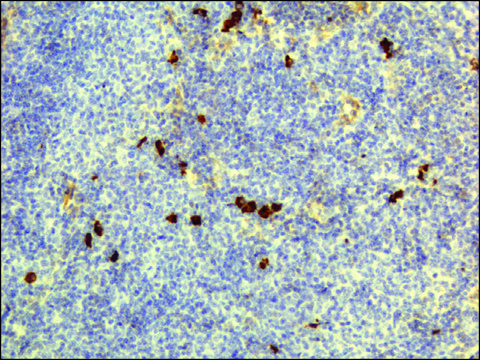 Anti-Human IgD antibody, Rabbit monoclonal recombinant, expressed in HEK 293 cells, clone RM123, purified immunoglobulin