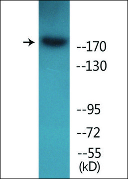 Anti-phospho-ALK (pTyr1604) antibody produced in rabbit affinity isolated antibody