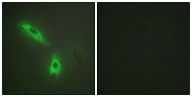 Anti-TNFC antibody produced in rabbit affinity isolated antibody