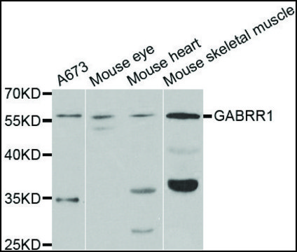 Anti-GABRR1 antibody produced in rabbit affinity isolated antibody