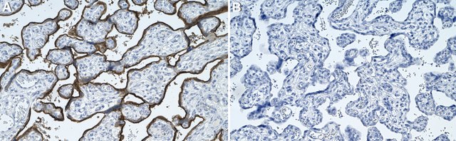 Anti-PD-L1/CD274 Antibody, clone 73-10 ZooMAb&#174; Rabbit Monoclonal recombinant, expressed in HEK 293 cells