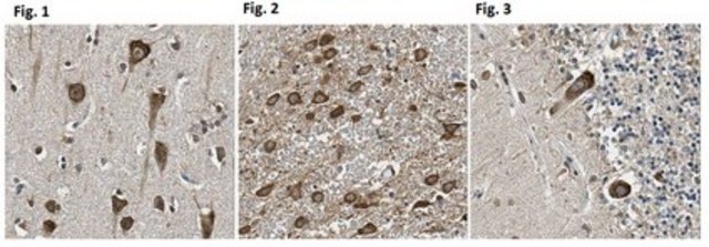 Anti-Cadherin-11/OB Cadherin Antibody from rabbit, purified by affinity chromatography