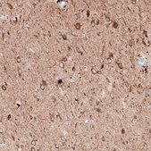 Monoclonal Anti-LAPTM4B antibody produced in mouse Prestige Antibodies® Powered by Atlas Antibodies, clone CL5289, purified immunoglobulin, buffered aqueous glycerol solution
