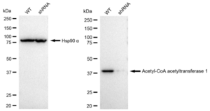 KD-Validated Anti Acetyl-CoA acetyltransferase 1 Antibody, clone 23GB1255, Rabbit Monoclonal clone 23GB1255, recombinant rabbit monoclonal, expressed in HEK293 cells