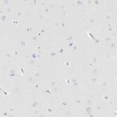 Anti-CPQ antibody produced in rabbit Prestige Antibodies® Powered by Atlas Antibodies, affinity isolated antibody, buffered aqueous glycerol solution, Ab2