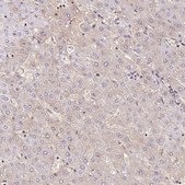 Anti-BLMH antibody produced in rabbit Prestige Antibodies® Powered by Atlas Antibodies, affinity isolated antibody, buffered aqueous glycerol solution