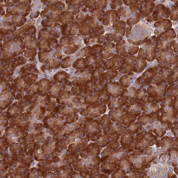 Anti-RPL17 antibody produced in rabbit Prestige Antibodies&#174; Powered by Atlas Antibodies, affinity isolated antibody, buffered aqueous glycerol solution