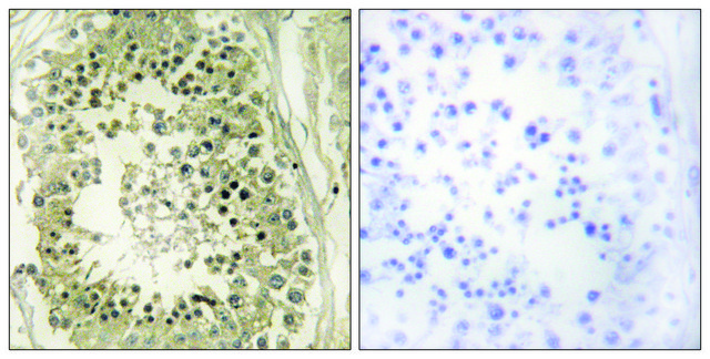 Anti-HGS antibody produced in rabbit affinity isolated antibody