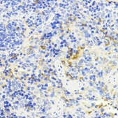 Anti-NFKB1 antibody produced in rabbit