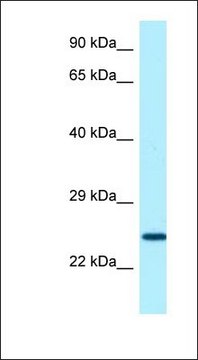 Anti-SOSTDC1 antibody produced in rabbit affinity isolated antibody