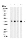 Anti-CAM kinase II Delta Antibody, clone 1E22 ZooMAb® Rabbit Monoclonal recombinant, expressed in HEK 293 cells