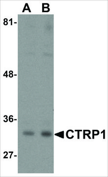 Anti-CTRP1 (ab1) antibody produced in rabbit affinity isolated antibody, buffered aqueous solution