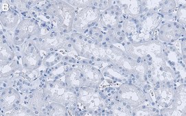 Anti-PDGF-C Antibody, clone 4D14 ZooMAb® Rabbit Monoclonal recombinant, expressed in HEK 293 cells