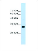 Anti-RNF121 antibody produced in rabbit IgG fraction of antiserum