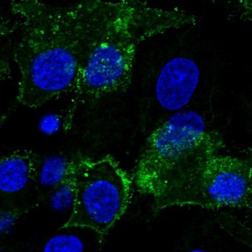 Anti-GPC3 antibody produced in rabbit Prestige Antibodies&#174; Powered by Atlas Antibodies, affinity isolated antibody, buffered aqueous glycerol solution