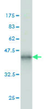 ANTI-ERN1 antibody produced in mouse clone 5F3, purified immunoglobulin, buffered aqueous solution