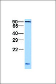 Anti-AARS antibody produced in rabbit affinity isolated antibody